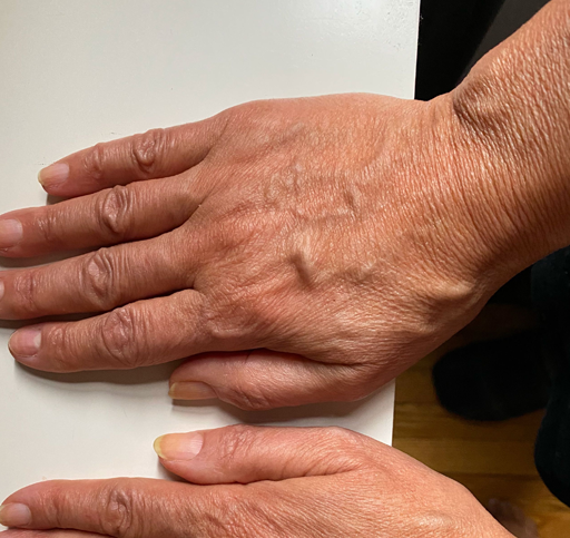 Arms/Hands