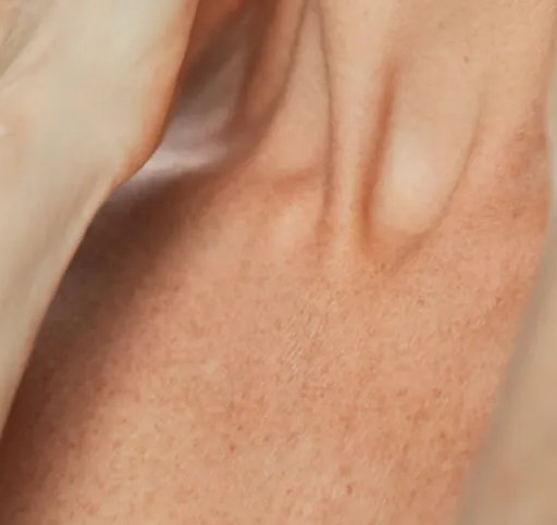 Chest/Decolletage