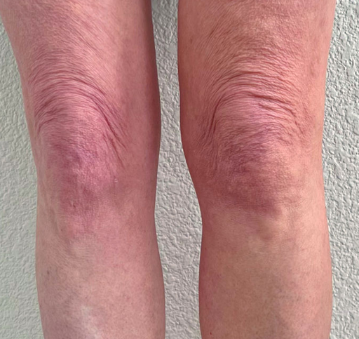 Legs/Knees