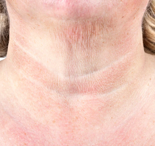 Neck